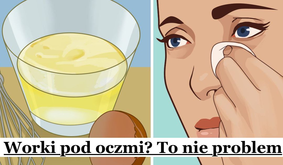 6 naturalnych sposobów na Worki pod Oczami