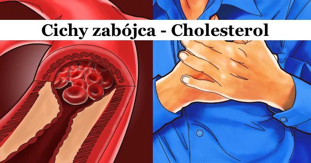 Proste Sposoby Walki Z Wysokim Poziomem Cholesterolu