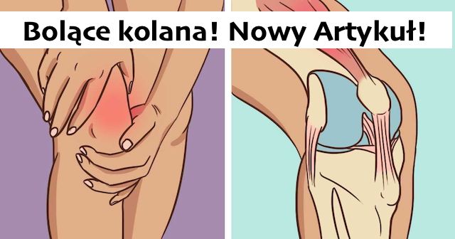 Naturalne środki łagodzące Ból W Kolanach I Stawach 3197