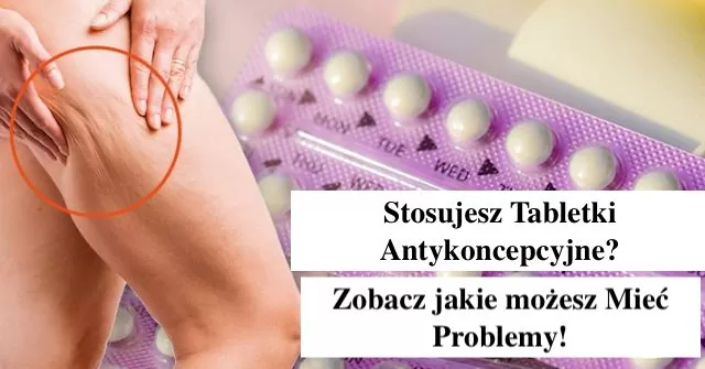 antykoncepcja - jakie tabletki stosujesz - porady